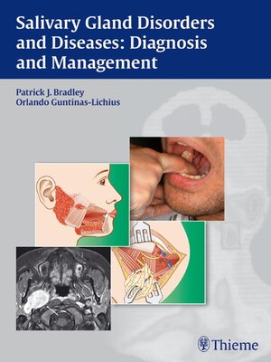 cover image of Salivary Gland Disorders and Diseases